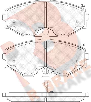 R Brake RB1569 - Bremžu uzliku kompl., Disku bremzes adetalas.lv